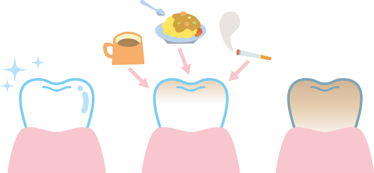 食事、喫煙などによる着色汚れが気になる方