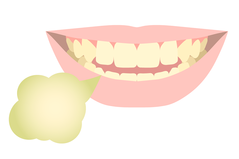 口臭が気になる方