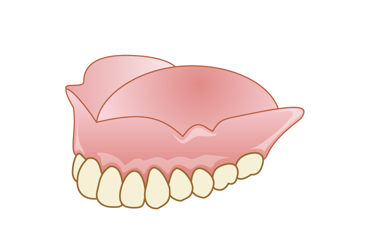 レジン床義歯