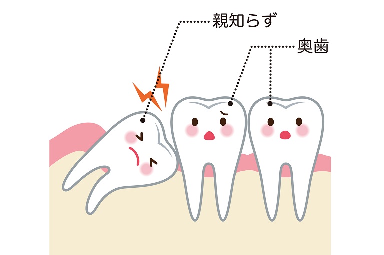 親知らず